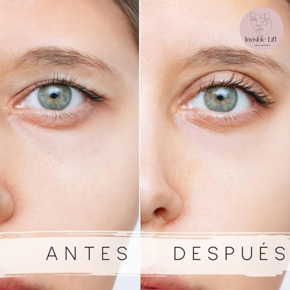 Cinta invisible levanta parpados INVISIBLE LIFT™ – SevenMarket
