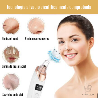 Removedor de puntos negros RADIANT PORE™