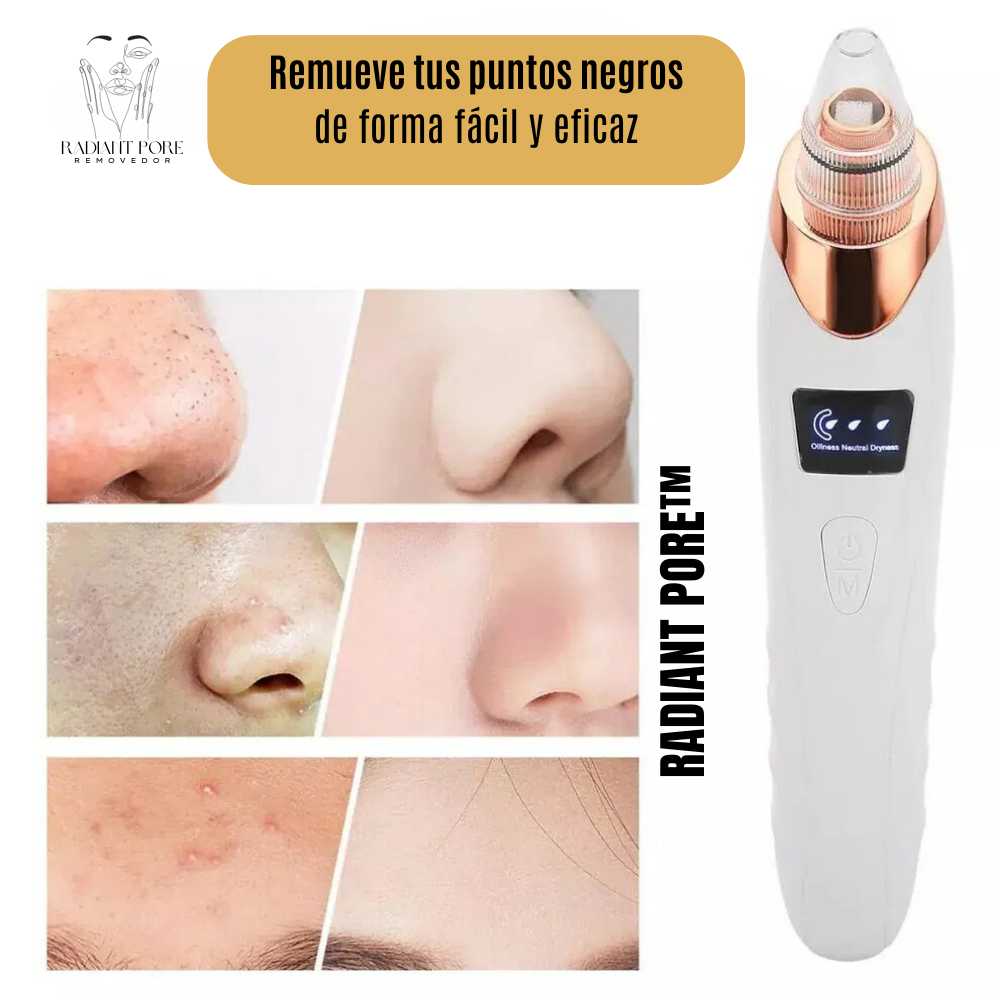 Removedor de puntos negros RADIANT PORE™